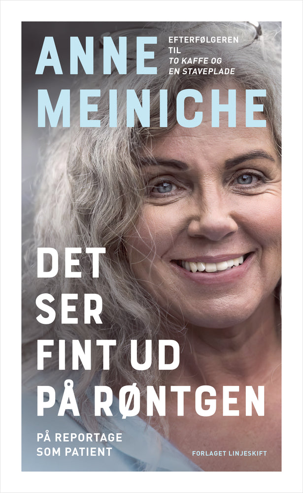 Det ser fint ud på røntgen