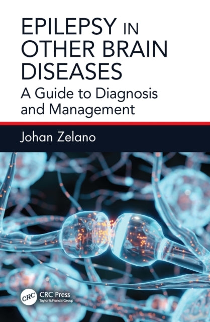 Epilepsy In Other Brain Diseases A Guide To Diagnosis and Ma