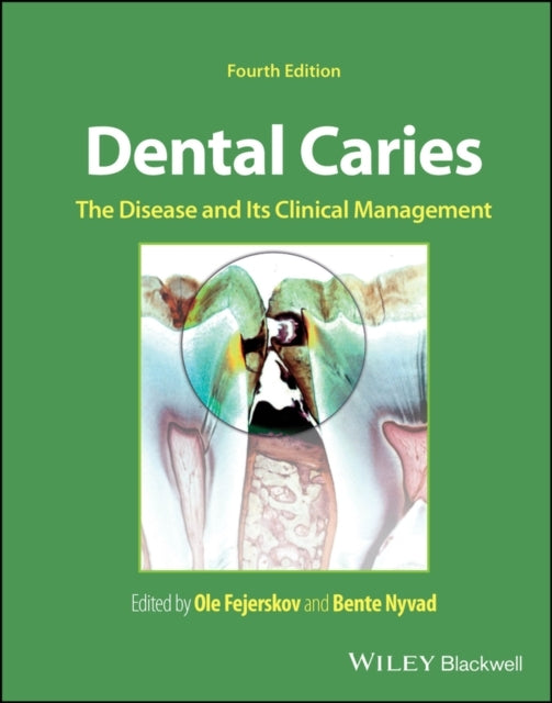 D2 Dental Caries