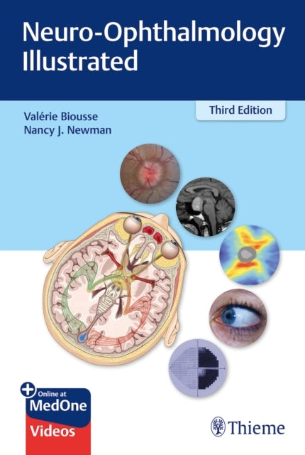 Neuro-ophthalmology Illustrated