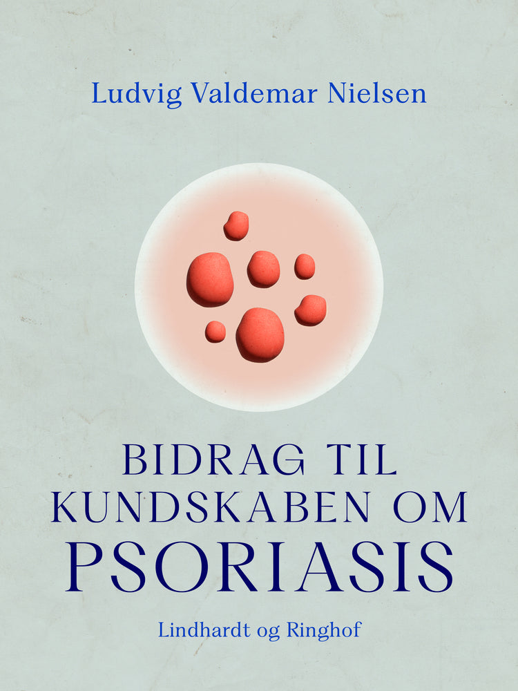 Bidrag til kundskaben om psoriasis