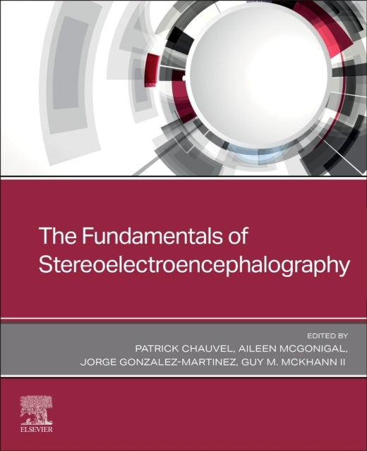 The Fundamentals Of Stereoelectroencephalography