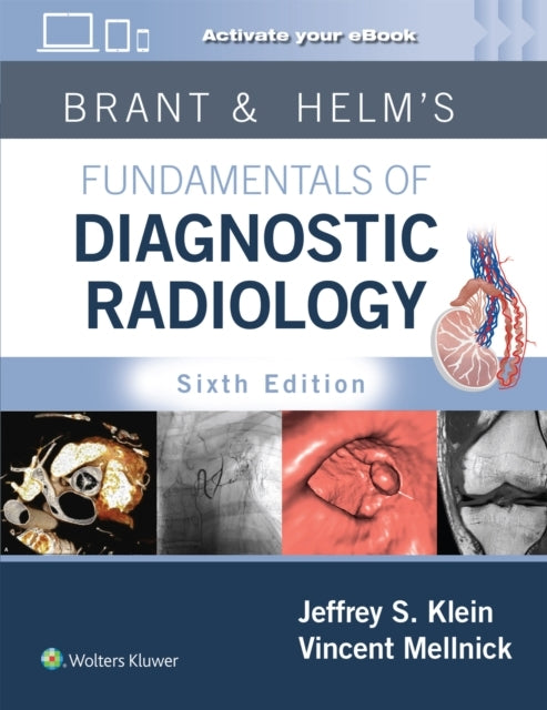 Brant & Helms' Fundamentals of Diagnostic Radiology Print +